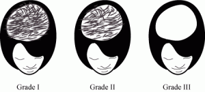 Ludwig Classification 