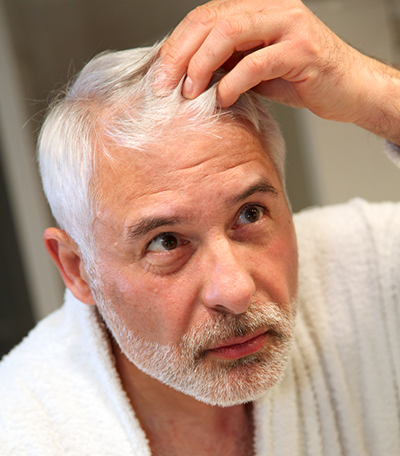 Hair Loss Causes Uncovered